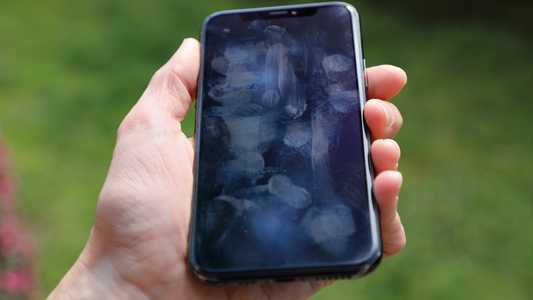 Do cellphones carry germs